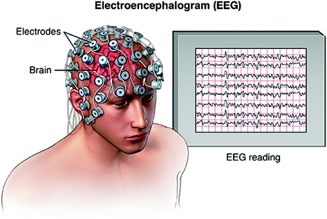 Electroencephalogram